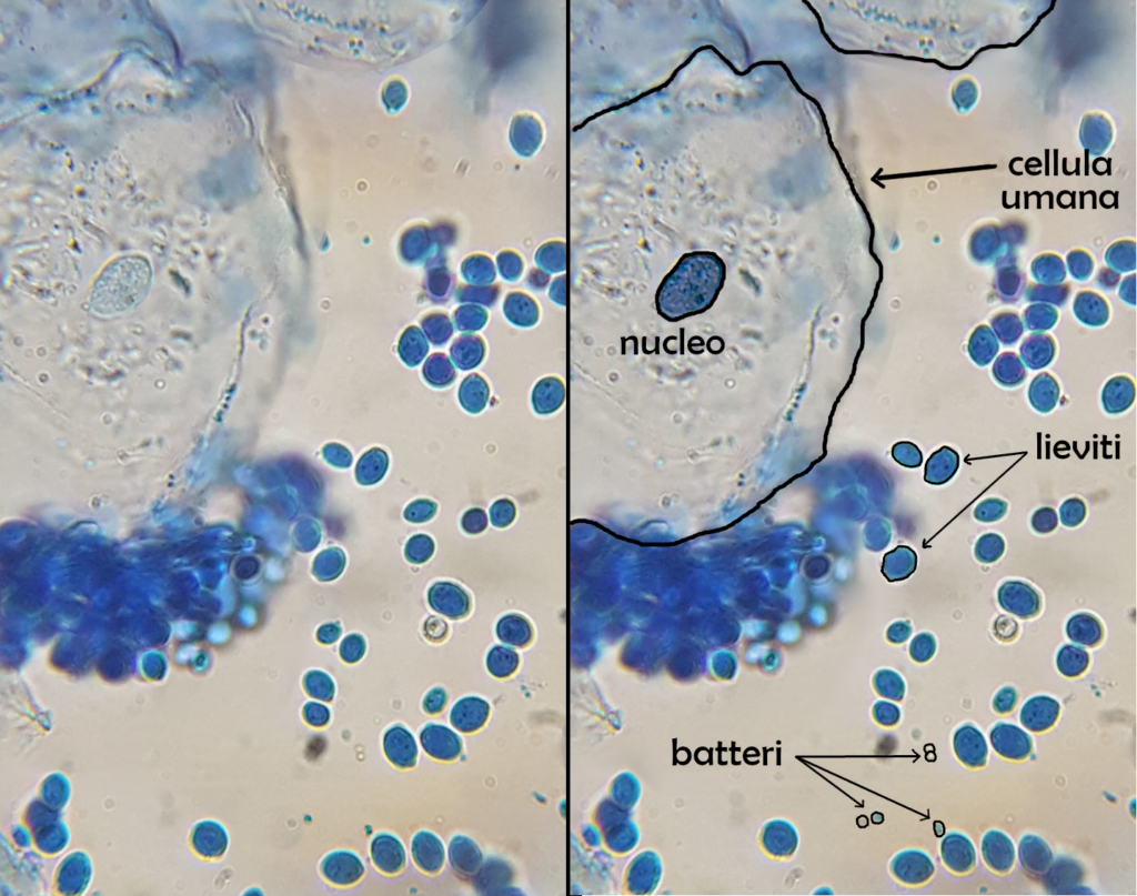 le diverse dimensioni di batteri, lieviti e cellule umane - immagini al microscopio